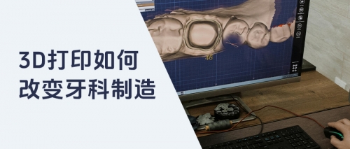 3D打印如何改变牙科制造