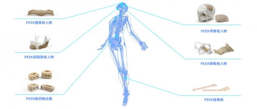PEEK材料与3D打印：高性能聚合物的制造新范式