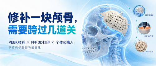 修补一块颅骨，需要跨过几道关