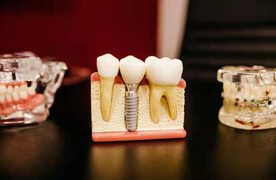 口腔行业3D打印