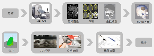 3D打印聚醚醚酮植入物的工作流程