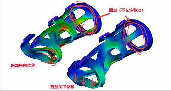 受伤肢体（本例为腕部）定制支架流程