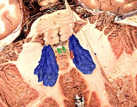 Three-dimensional visualization of deep cerebellar nuclei