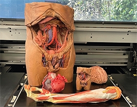 Monash University uses Mimaki full-colour 3D printer to achieve realistic human anatomy models and break new ground for medical education